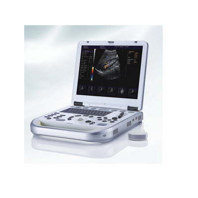 全数字彩色多普勒超声实时引导可视人流/宫腔诊疗系统 HY-M60
