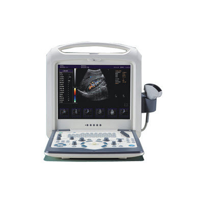 全数字彩色多普勒超声实时引导可视人流/宫腔诊疗系统  HY-M30